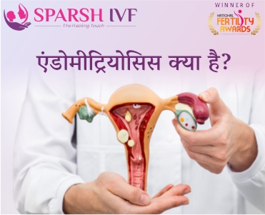 एंडोमीट्रियोसिस का इलाज, एंडोमीट्रियोसिस का खर्चा, एंडोमीट्रियोसिस के लक्षण, एंडोमीट्रियोसिस की जांच, एंडोमीट्रियोसिस का उपचार - स्पर्श आईवीएफ